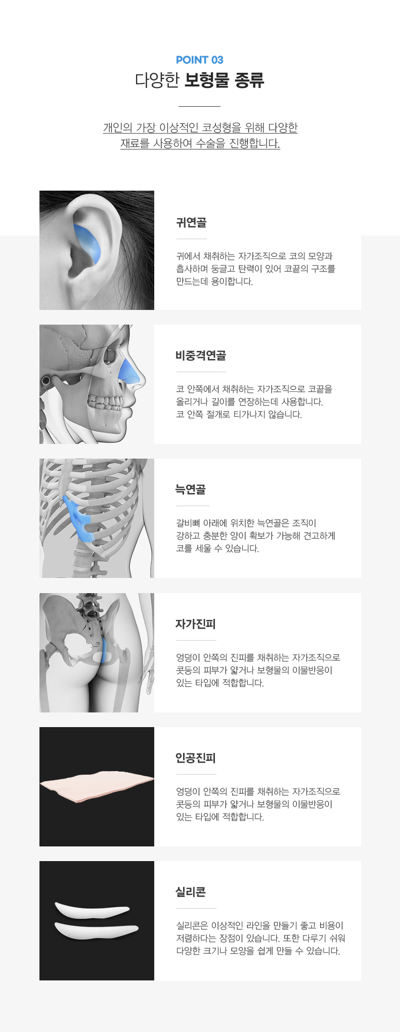 세란 코성형 point3