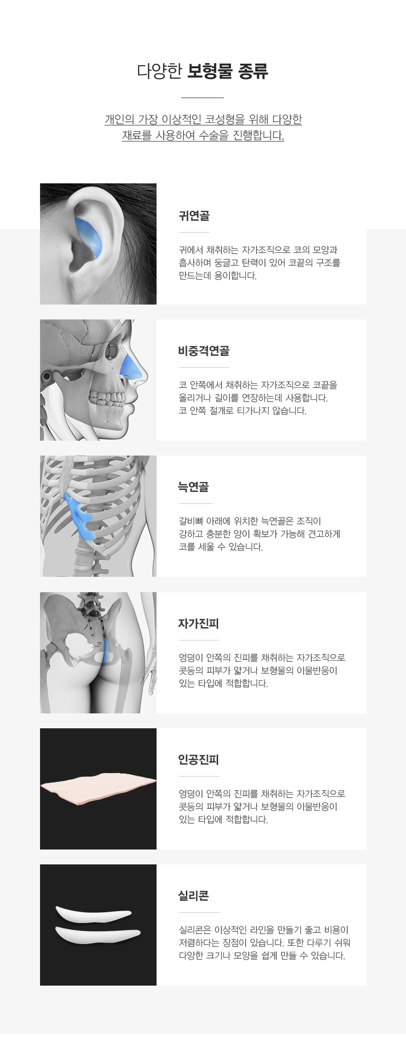 매부리코 성형 보철물 종류